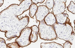 PD-L1 Antibody in Immunohistochemistry (Paraffin) (IHC (P))