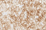 PD-L1 Antibody in Immunohistochemistry (Paraffin) (IHC (P))