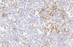 PD-L1 Antibody in Immunohistochemistry (Paraffin) (IHC (P))