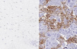 PD-L1 Antibody in Immunohistochemistry (Paraffin) (IHC (P))