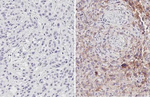 PD-L1 Antibody in Immunohistochemistry (Paraffin) (IHC (P))