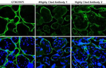 PD-L1 Antibody in Immunohistochemistry (Paraffin) (IHC (P))