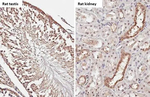 Androgen Receptor Antibody in Immunohistochemistry (Paraffin) (IHC (P))