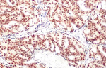 Androgen Receptor Antibody in Immunohistochemistry (Paraffin) (IHC (P))
