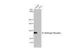 Androgen Receptor Antibody in Western Blot (WB)