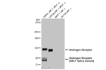 Androgen Receptor Antibody in Western Blot (WB)