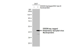 RSV NP Antibody in Western Blot (WB)