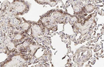 CD44 Antibody in Immunohistochemistry (Paraffin) (IHC (P))
