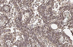 CD44 Antibody in Immunohistochemistry (Paraffin) (IHC (P))