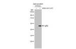 p53 (Tumor Suppressor Protein) Recombinant Rabbit Monoclonal Antibody (HL2699)