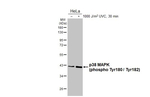 Phospho-p38 MAPK (Thr180, Tyr182) Recombinant Rabbit Monoclonal Antibody (HL2742)