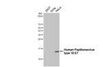 HPV Type 18 E7 Antibody in Western Blot (WB)