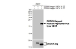 HPV Type 18 E7 Antibody in Western Blot (WB)
