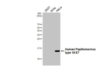 HPV Type 18 E7 Antibody in Western Blot (WB)