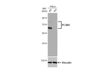 PCSK9 Recombinant Rabbit Monoclonal Antibody (HL2815)