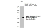 Phospho-Ezrin/Radixin/Moesin (Thr567, Thr564, Thr558) Recombinant Rabbit Monoclonal Antibody (HL2909)