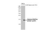 H3K27ac Recombinant Rabbit Monoclonal Antibody (HL2936)