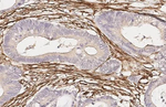 Alpha-Smooth Muscle Actin Antibody in Immunohistochemistry (Paraffin) (IHC (P))