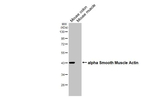 Alpha-Smooth Muscle Actin Antibody in Western Blot (WB)