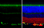 RBPMS Antibody in Immunohistochemistry (Paraffin) (IHC (P))