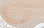 DRD5 Antibody in Immunohistochemistry (Paraffin) (IHC (P))