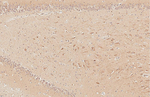 DRD5 Antibody in Immunohistochemistry (Paraffin) (IHC (P))