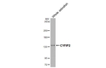 CYFIP2 Antibody in Western Blot (WB)
