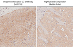 DRD2 Antibody in Immunohistochemistry (Paraffin) (IHC (P))