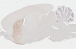 DRD2 Antibody in Immunohistochemistry (Paraffin) (IHC (P))