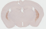 DRD2 Antibody in Immunohistochemistry (Paraffin) (IHC (P))