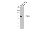 PSD-95 Antibody in Western Blot (WB)