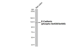 Phospho-E-cadherin (Ser838, Ser840) Antibody in Western Blot (WB)