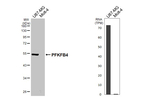 PFKFB4 Recombinant Rabbit Monoclonal Antibody (HL3254)