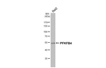 PFKFB4 Antibody in Western Blot (WB)