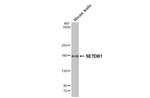 SETDB1 Antibody in Western Blot (WB)