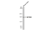 SETDB1 Antibody in Western Blot (WB)