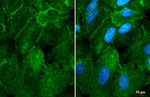 alpha-1d Adrenoceptor Antibody in Immunocytochemistry (ICC/IF)