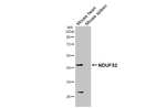 NDUFS2 Antibody in Western Blot (WB)