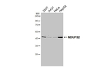 NDUFS2 Recombinant Rabbit Monoclonal Antibody (HL3269)
