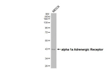 alpha-1a Adrenergic Receptor Antibody in Western Blot (WB)