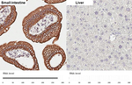 Cytokeratin 20 Antibody in Immunohistochemistry (Paraffin) (IHC (P))