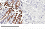Cytokeratin 20 Antibody in Immunohistochemistry (Paraffin) (IHC (P))