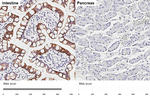 Cytokeratin 20 Recombinant Rabbit Monoclonal Antibody (HL3309)