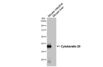 Cytokeratin 20 Antibody in Western Blot (WB)