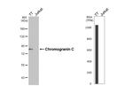 Chromogranin C Antibody in Western Blot (WB)