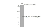 Phospho-PLCG2 (Tyr759) Recombinant Rabbit Monoclonal Antibody (HL3329)