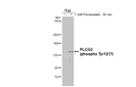 Phospho-PLCG2 (Tyr1217) Recombinant Rabbit Monoclonal Antibody (HL3332)