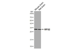 RPS2 Recombinant Rabbit Monoclonal Antibody (HL3338)