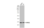 RPS2 Antibody in Western Blot (WB)