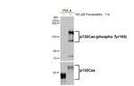 Phospho-p130Cas (Tyr165) Antibody in Western Blot (WB)